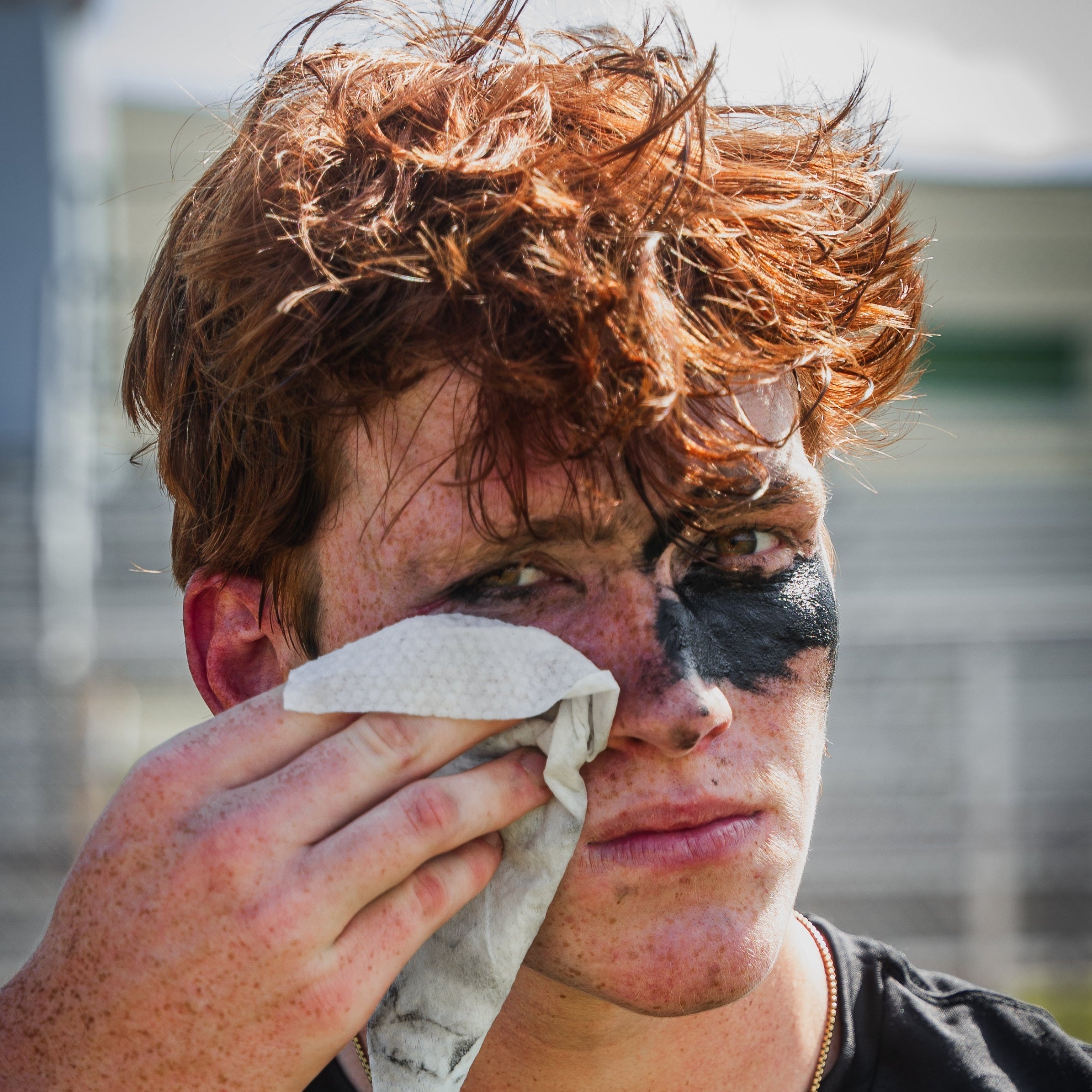 Why Summer Is So Hard on Your Skin and the 30 Minute Rule Every Athlete Should Know
