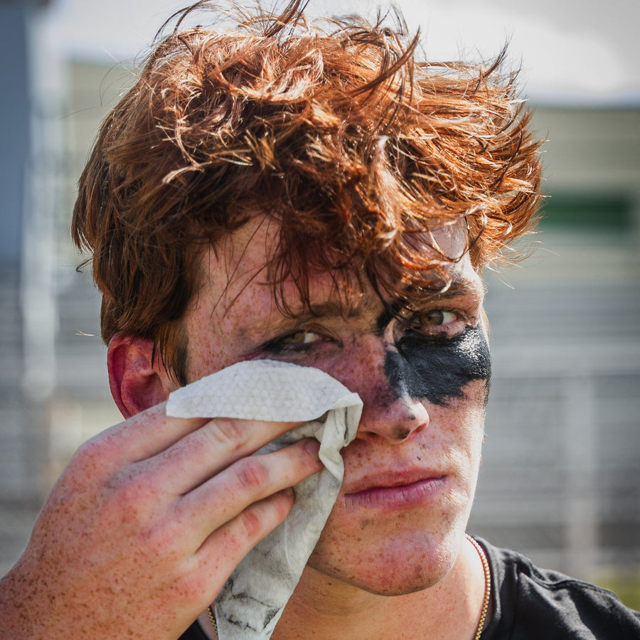 Why Summer Is So Hard on Your Skin and the 30 Minute Rule Every Athlete Should Know